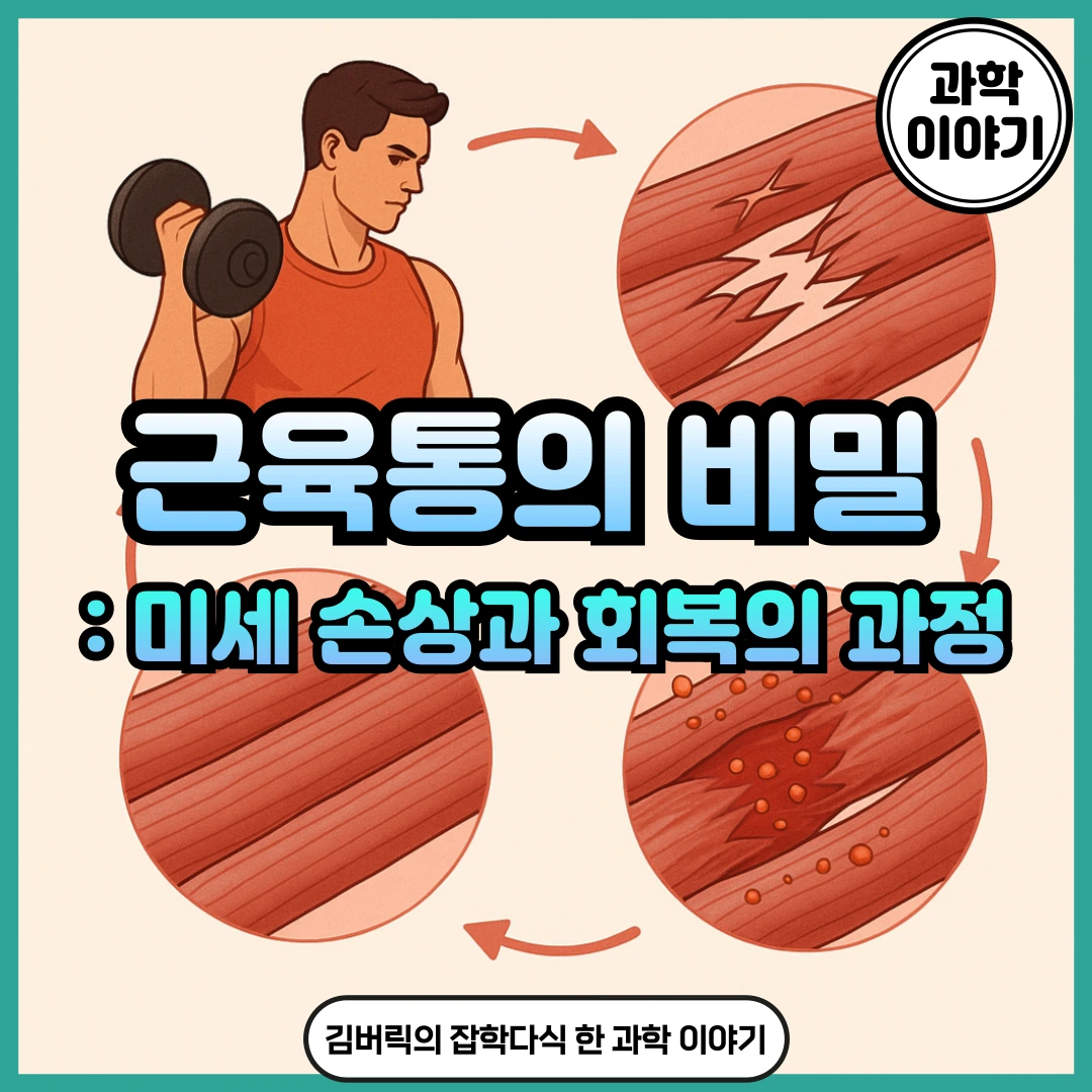 지연성 근육통